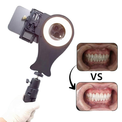 口腔写真用スタンド V4 – すべてのiPhoneおよびAndroidモデルに対応