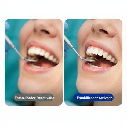 医療・歯科・美容施術向け録画カメラ – 4K / 30FPS